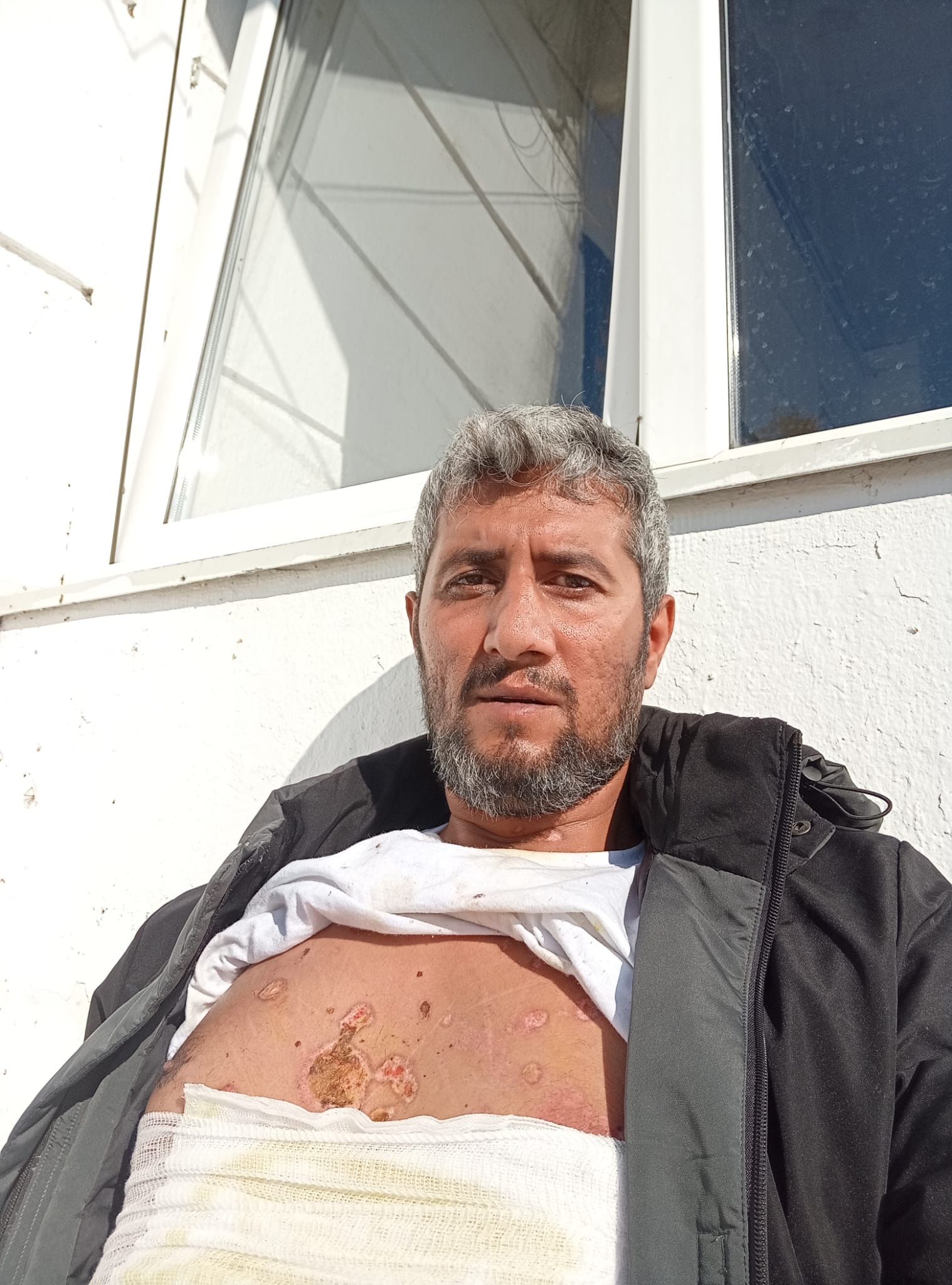 Iranian man says Israel activism led to near-fatal attack by fellow refugees