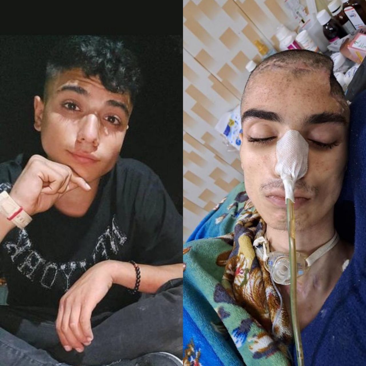 مقتل متظاهر إيراني بعد 8 أشهر من إصابته بعبوة غاز مسيل للدموع في رأسه