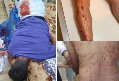 10 مصابين إثر مظاهرات ليلية في آبدانان إيران.. احتجاجا على وفاة غامضة لطالب جامعي