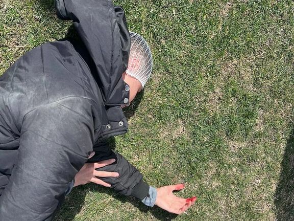 حمله به بازیکنان تراکتور؛ چند نفر مصدوم و بستری شدند، همه چیز دزدیده شد