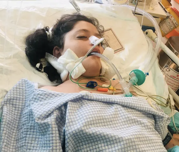 قائد سابق بالحرس الثوري الإيراني:الطب الشرعي يكشف أن وفاة مهسا أميني بسبب ضرب على الجمجمة