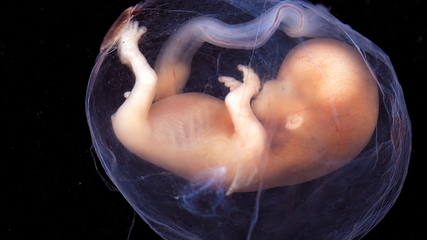 An illustrative image of a fetus in an amniotic sac.