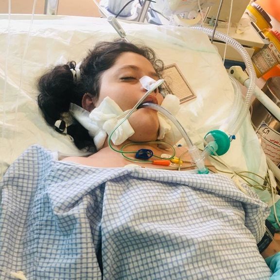 یک منبع بیمارستانی به ایران اینترنشنال: لهشدگی بافت مغزی مهسا در پی «ضربات متعدد» به سر