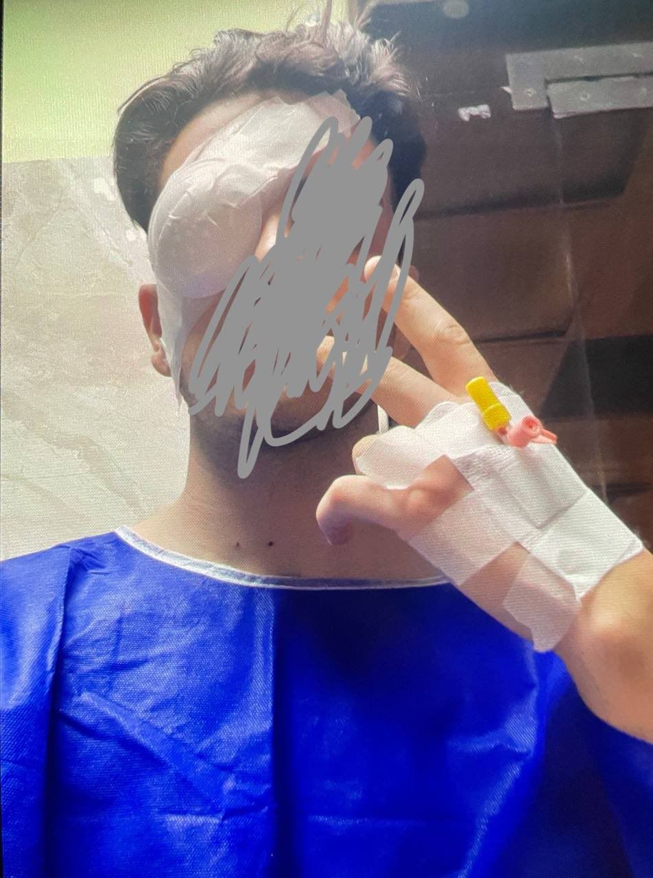 Doctors Say Iran’s Use Of ‘Birdshots’ Blinded Hundreds Of People  