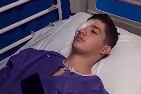 مراهق إيراني يصاب بالعمى بعد 16 شهرا من إطلاق الشرطة عبوة غاز في وجهه أثناء الاحتجاجات