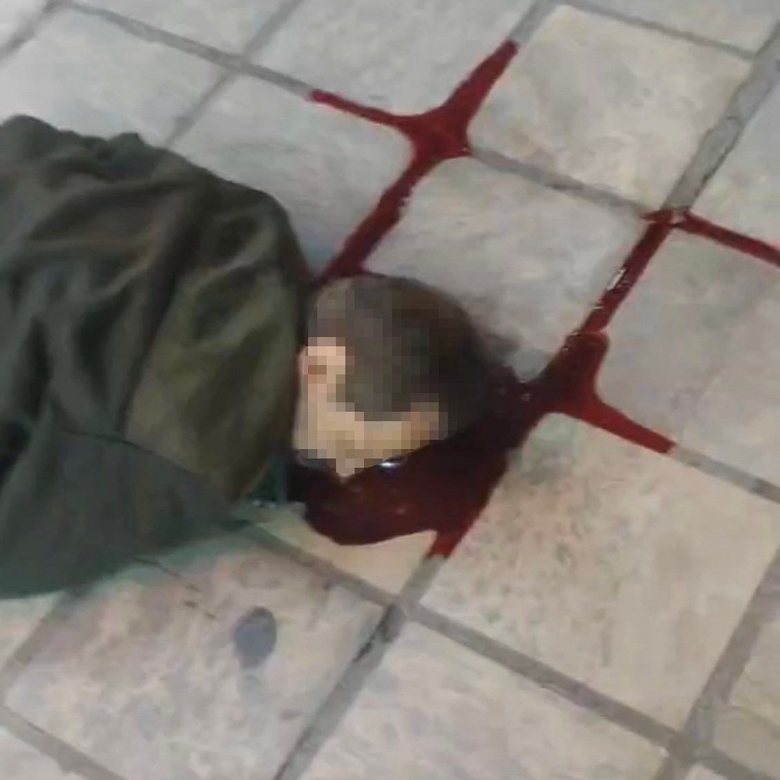 A protester hit in the head during protests  (March 2023)