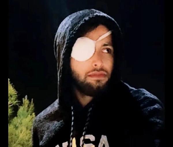 Iranian Protester Who Lost Eye In 2022 Protests Sentenced To Prison 