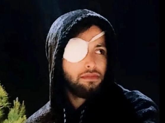 حسین حسین پور، از آسیبدیدگان چشمی خیزش انقلابی، به یک سال زندان محکوم شد