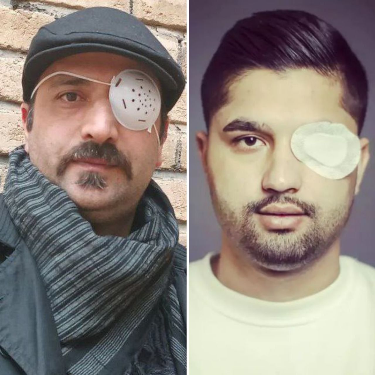 تهدید و بازداشت آسیب‌دیدگان چشمی اعتراضات؛ امیر ولایتی و هرش نقشبندی بازداشت شدند