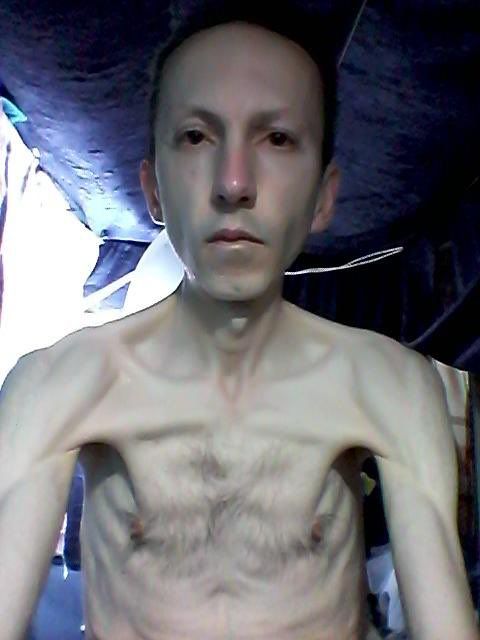 احمدرضا جلالی بارها در اعتراض به شرایط خود دست به اعتصاب غذا زده است و در شرایط نامناسبی به‌سر می‌برد