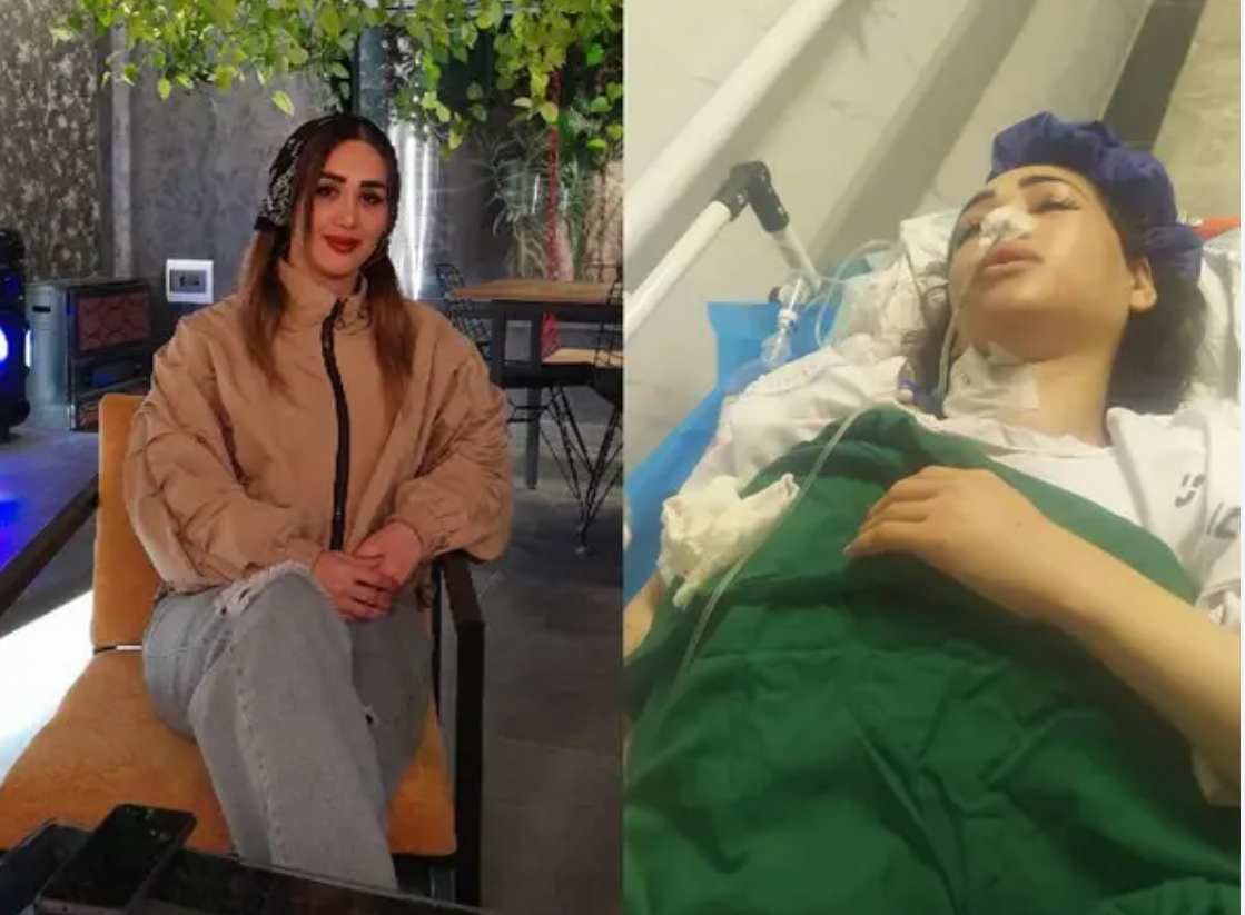 Badri before and after being shot by the police in July