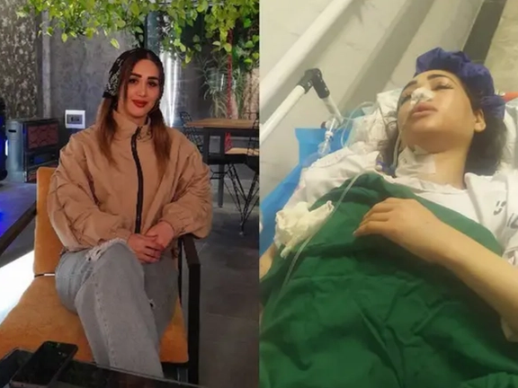 Badri before and after being shot by the police in July