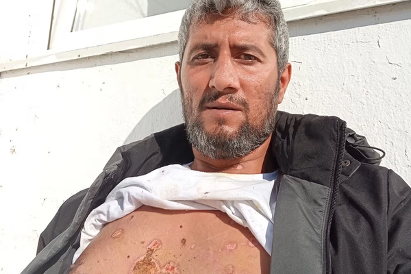 ناشط سياسي إيراني: تعرّضتُ للتعذيب في مخيم للاجئين بسبب عدائي لنظام طهران