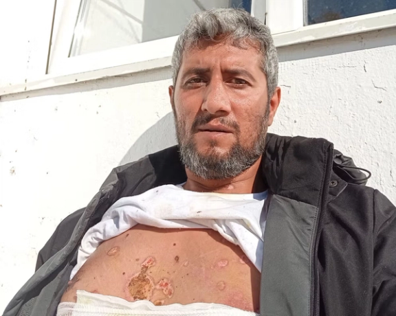 ناشط سياسي إيراني: تعرّضتُ للتعذيب في مخيم للاجئين بسبب عدائي لنظام طهران