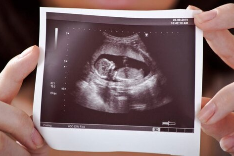 مصوبه مجلس: برای سقط جنین تصمیم مادر تعیین کننده نیست؛ شورایی با عضویت دو فقیه نظر میدهد