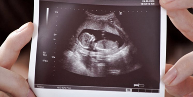 رغم التحذيرات الأممية.. إيران تفرض قيودًا على الإجهاض وتشدد العقوبات على "المتورطين" فيه