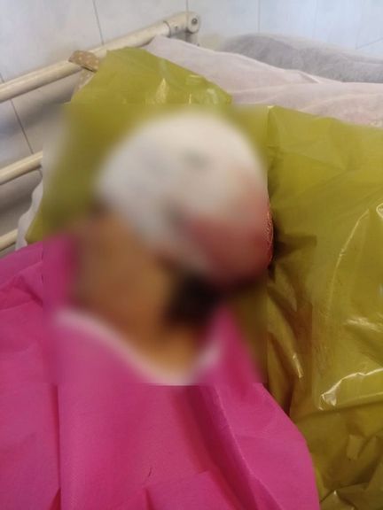 برکناری رییس بنیاد شهید کلاردشت بعد از مجروح کردن دو نفر با داس