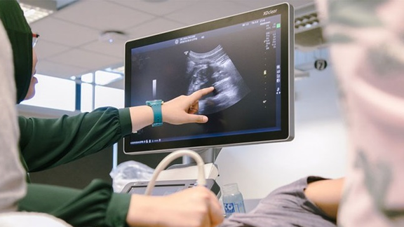 وزارت بهداشت: سونوگرافی زنان باید فقط توسط رادیولوژیست زن انجام بگیرد