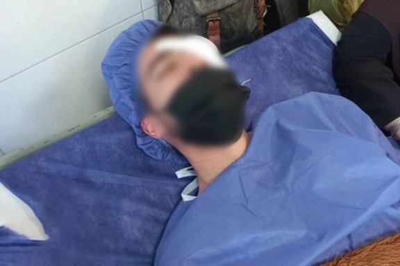 هشدار دهها متخصص چشم درباره نابینا شدن معترضان با شلیک ساچمه از سوی ماموران جمهوری اسلامی