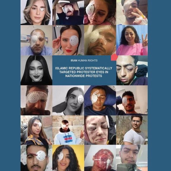 A combo photo of some of the protesters whose eyes were injured by security forces