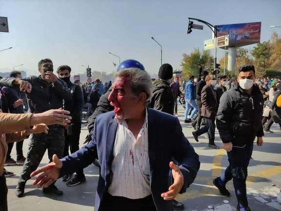 Protester injured in the face by security forces in Esfahan, Iran. November 26, 2021