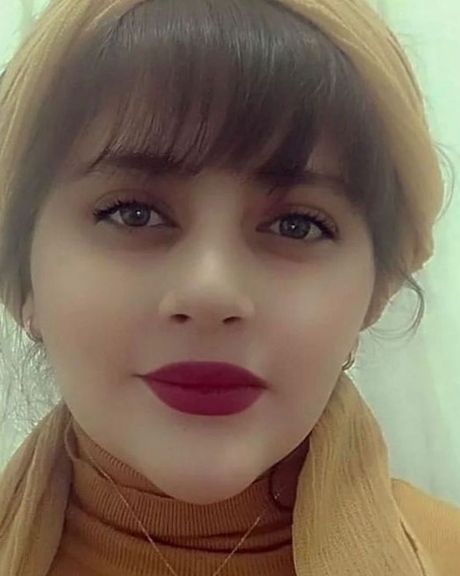 پزشکی قانونی: اثر ضرب و جرح در سر و صورت و شکستگی در قاعده جمجمه مهسا امینی ندیدیم