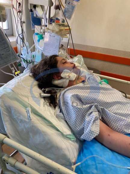 Mahsa Amini in the hospital in coma before she passed away on September 16, 2022