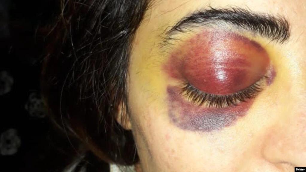 Iranian Female Protester Sentenced To 11 Years And Washing Graves