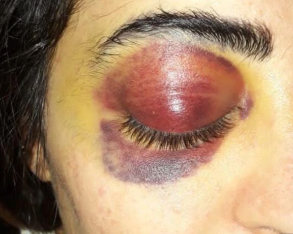 Mina Yaqubi after her release from prison