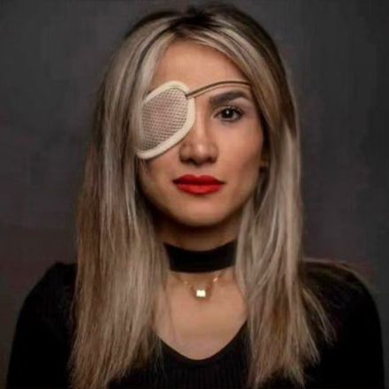 Blinded protestor says Iran's fight has moved beyond the hijab 