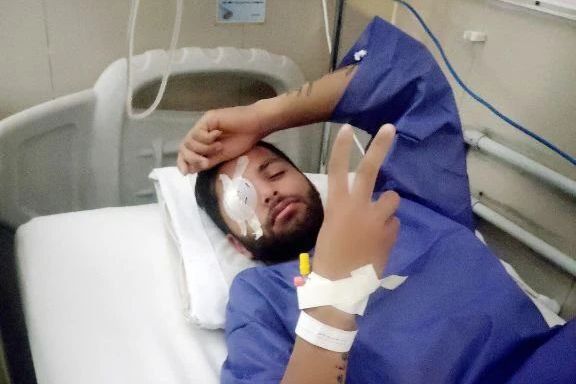 حسین حسینپور، معترض مجروح: بیمارستان شیراز بیدلیل عمل پیوند قرنیهام را لغو کرد