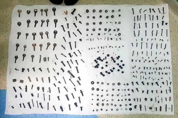 رییس بیمارستان امام اهواز: سه کیلو پیچ و مهره از شکم یک بیمار خارج کردیم