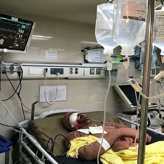 رییس بیمارستان سوانح سوختگی مطهری: در تامین بسیاری از تجهیزات درمان سوختگی مشکل داریم