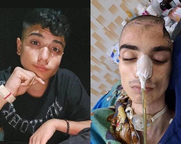Abolfazl Amir-Ataei before his injury and in hospital