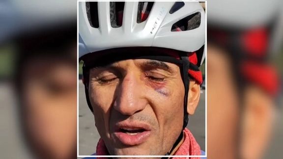 حمله با پنجه بوکس و اسپری فلفل به حسین عسگری دوچرخهسوار تیمملی ایران