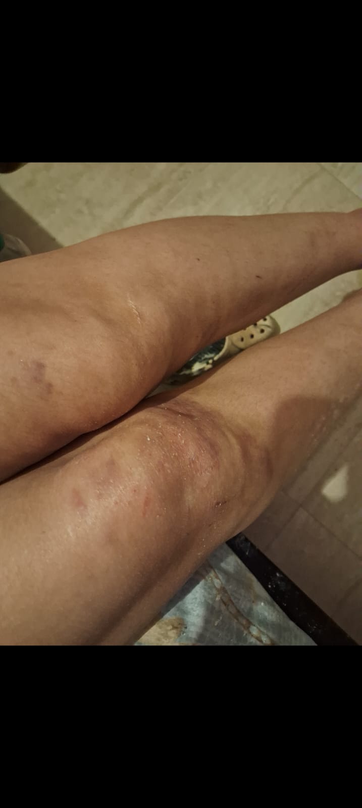 شکنجه، تحقیر و تهدید به اعدام؛ روایت یک بازداشتی آزادشده