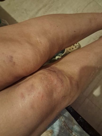 شکنجه، تحقیر و تهدید به اعدام؛ روایت یک بازداشتی آزادشده