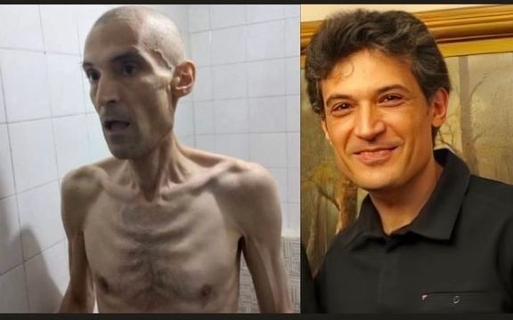 World Outraged By Shocking Photos Of Hunger-Striking Political Prisoner