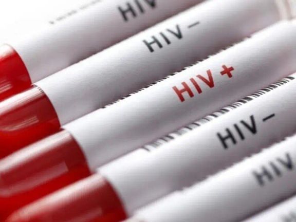 في اليوم العالمي للإيدز.. "الصحة" الإيرانية: ارتفاع كبير في عدد المصابات النساء