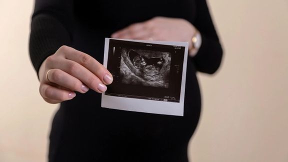 مقام دانشگاه علوم پزشکی: بعضی والدین با عکس جنین برای بچه خود صفحه اینستاگرام درست میکنند